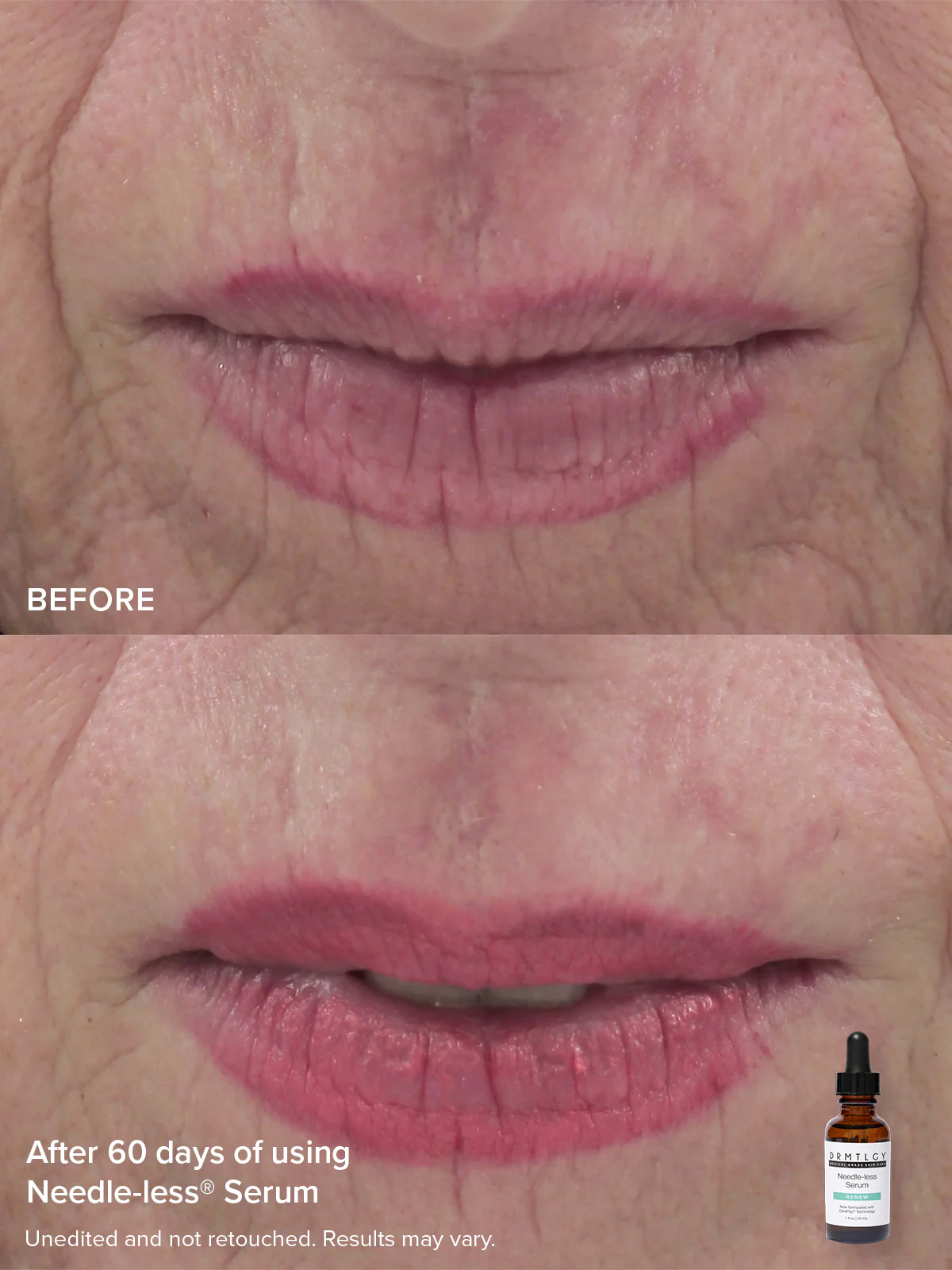 The Needle-less® Duo - Image 7